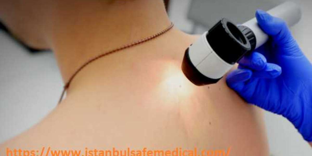 Skin cancer treatment turkey