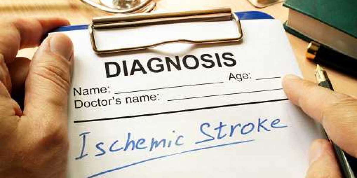 Ischemic Stroke Market Definitions, Classifications, Applications by 2023
