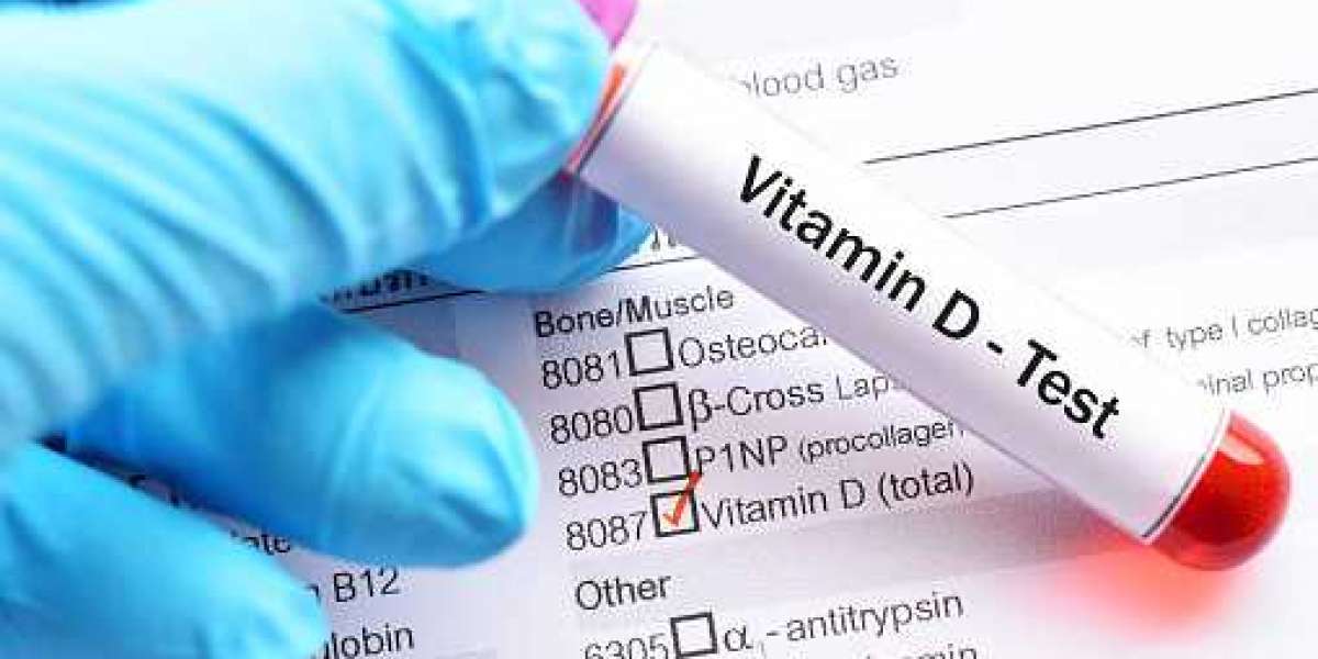 Vitamin D Testing Market Elaborates Outlook to 2027